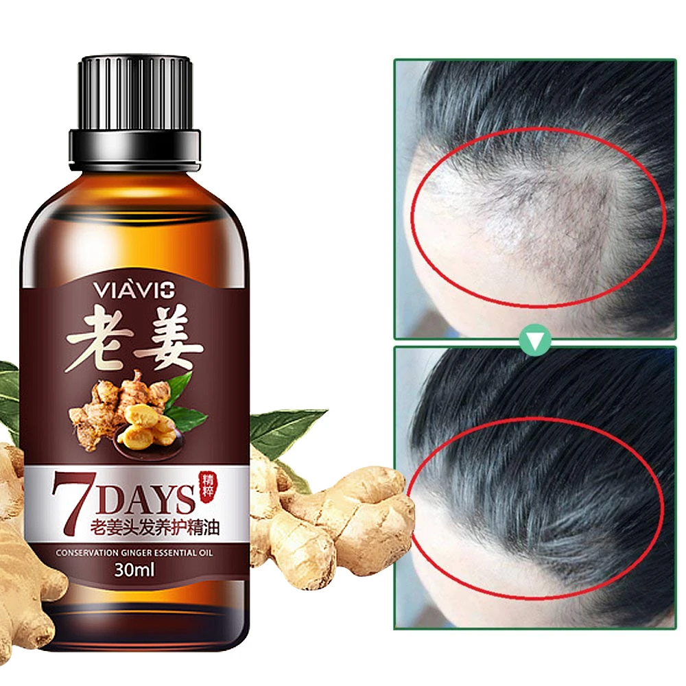 Продукты против выпадения волос Натуральное масло для роста маска имбирь