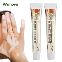 20g white spot ointment vitiligo cream cure antibacterial cream localized mycosis leukoplakia plaster promote pigment melanin
