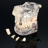 dental model teeth implant restoration bridge teaching study medical science disease dentist dentistry products