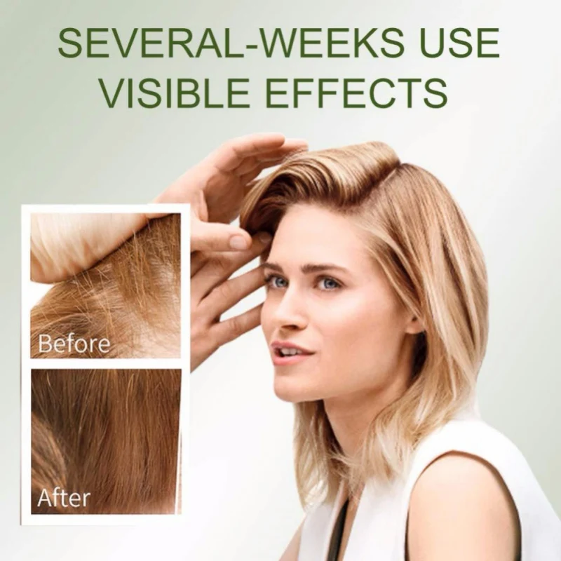 

Hair Growth Essence For Hair Treatment To Prevent Loss, Repair Damaged Hair And Restore Hair For Men And Women