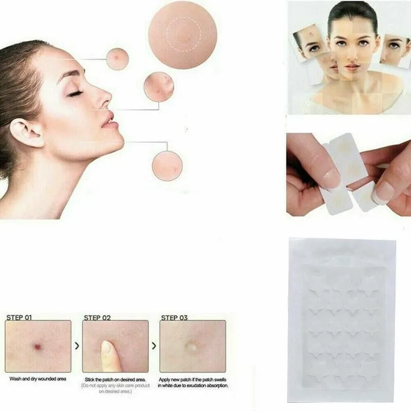 18pcs/sheet Removal Skin Tag Blackhead Blemish Hydrocolloid Acne Invisible Pimple Master Patch Acne Treatment Care Tools