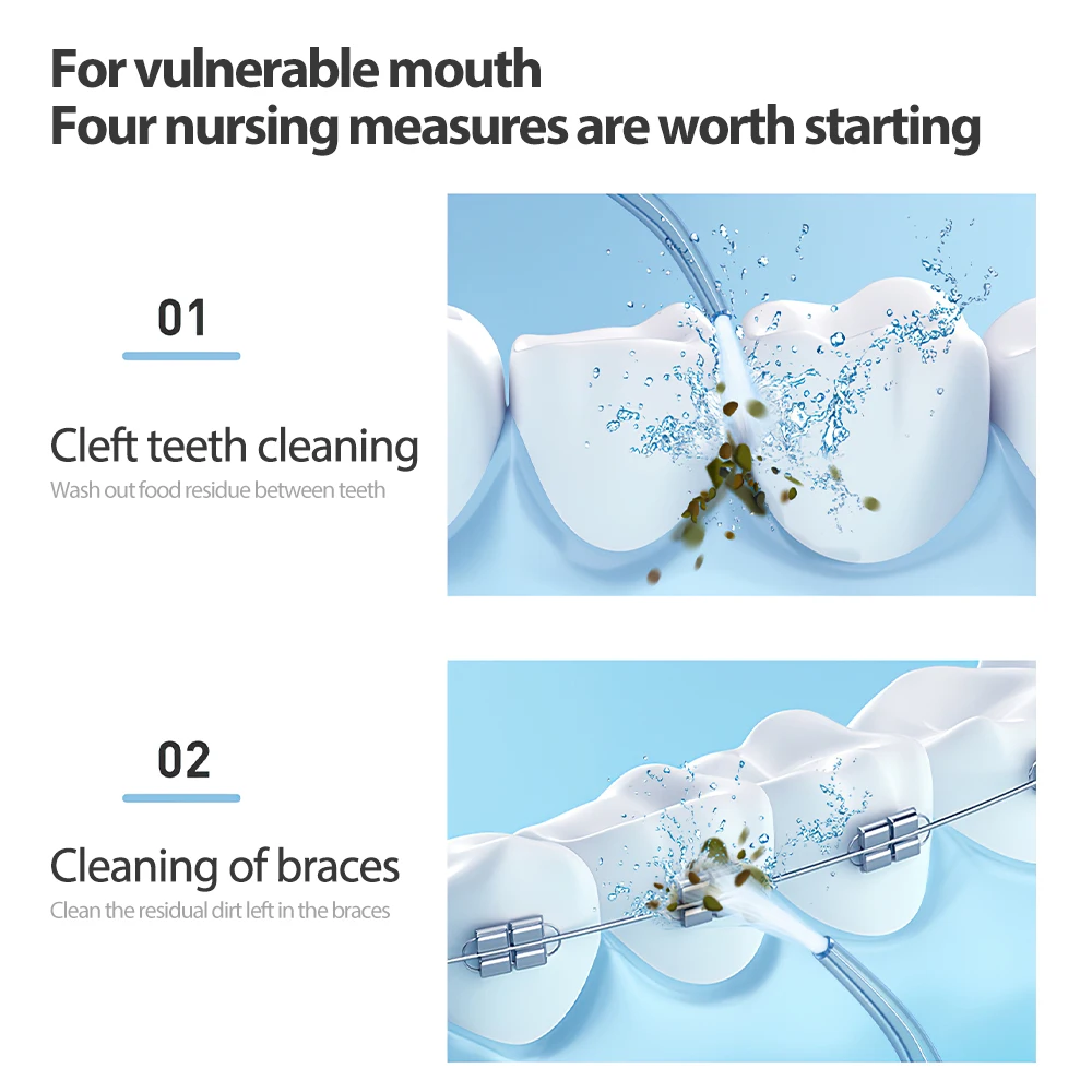 

Cordless Oral Irrigator Portable Water Dental Flosser USB Rechargeable Water Jet Floss Tooth Pick 4 Jet Tip 170ml Teeth Cleaner