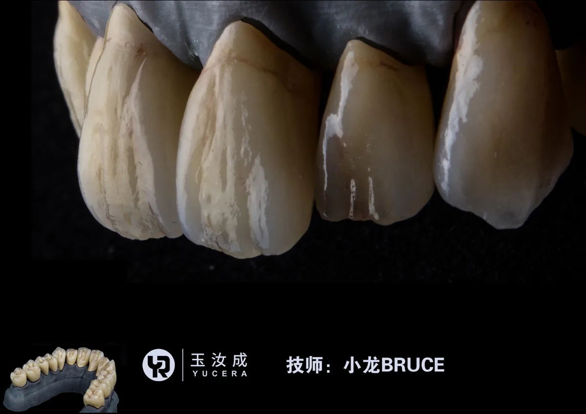 

Zirkon Zahn Multi Zirconia Block Disk Disc For Laboratorio Dental 95mm CADCAM Porcelain Zirconium Blank For Protese Dentaria