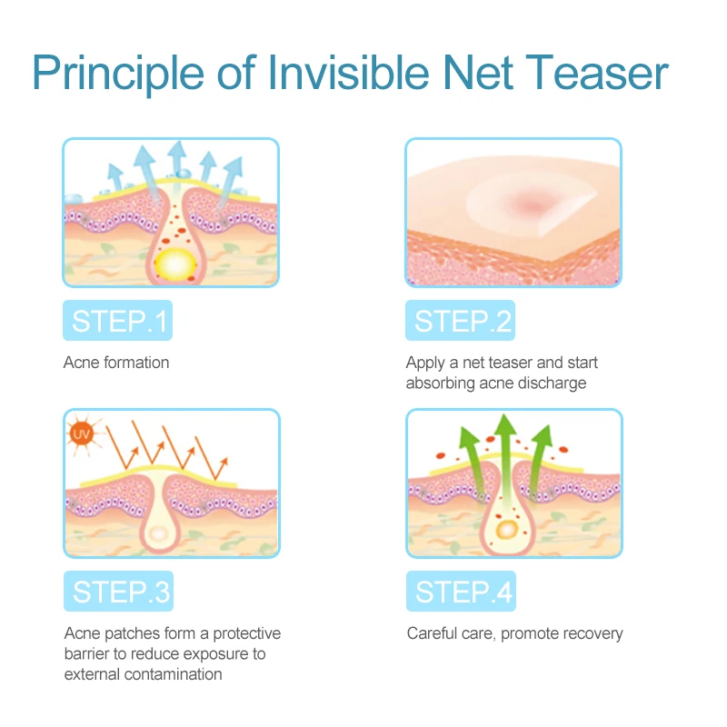 Патчи от акне натуральные поглощающие прыщи патчи медицинские Гидроколлоидные es