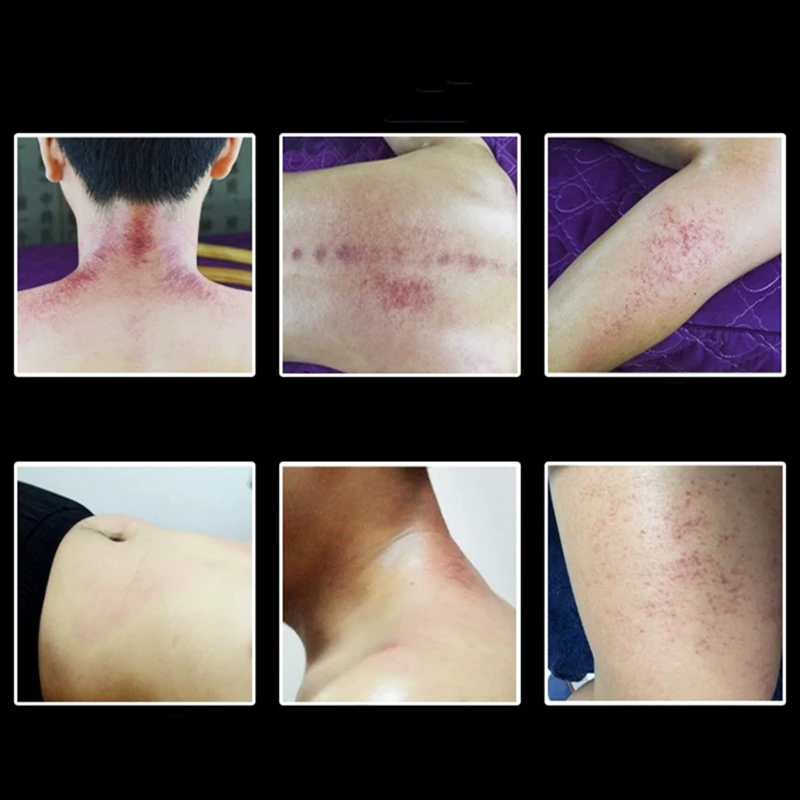 

4 Pcs Guasha Scraping Stick for Back Shoulder Neck Waist Leg Massage Tools Made From Natural Wood Fast Large Area