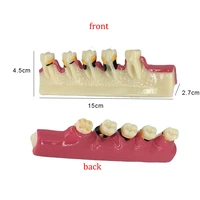 dental periodontal disease tooth model pathological teaching resin teeth dentist communication dentistry lab study trainingm4010