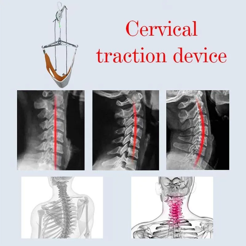 

Cervical Traction Device Portable Over Door Neck Massager Kit Stretcher Adjustment Chiropractic Back Head Massager Relaxation