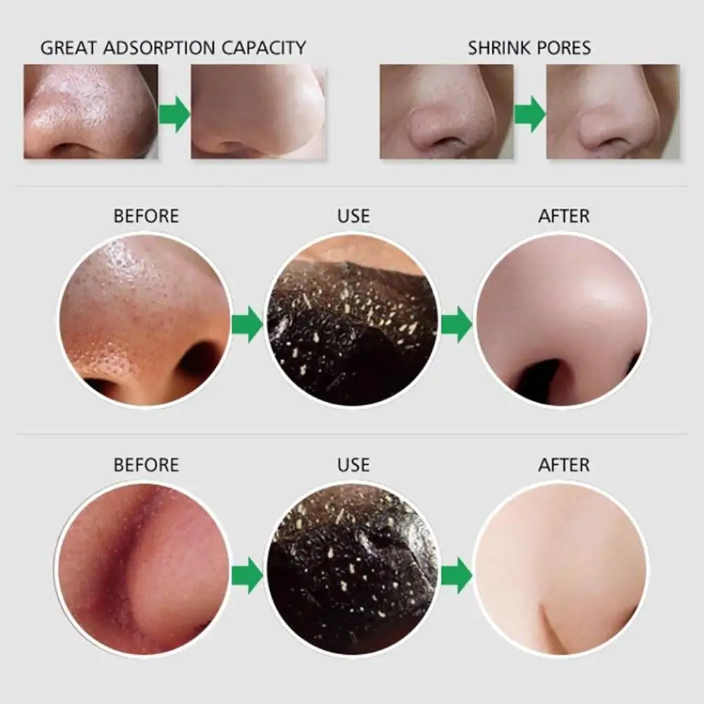 

Acne Treatment Head Pore Deep Black Mask Nose Blackhead Remover A9X1 Nose Cleaner Cleasing Strips Pore Tool Remover Mask B9U1