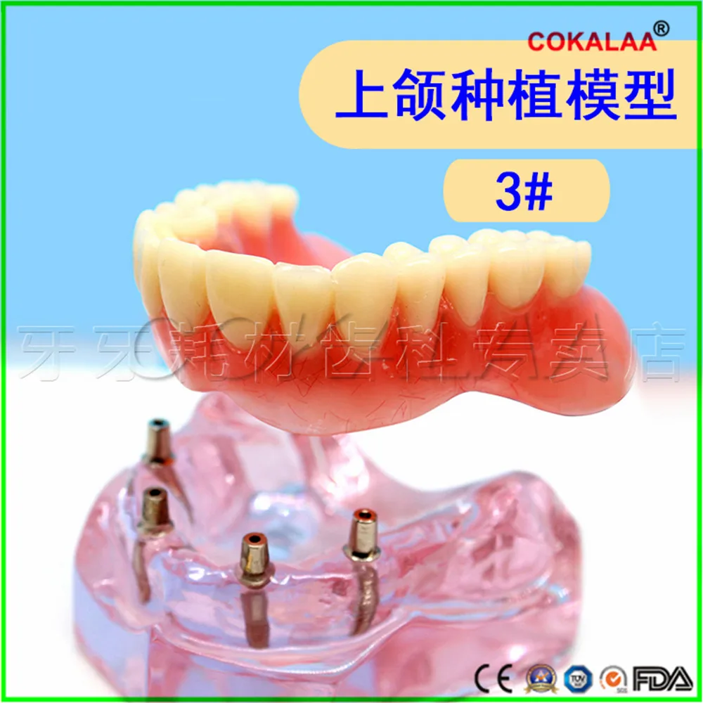Модель верхней челюсти для зубных имплантатов с зубными протезами хорошего качества для обучения стоматологов.