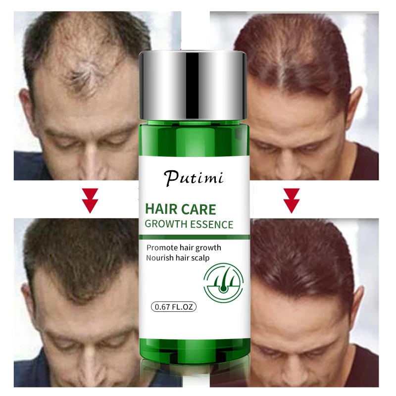 

Anti-Hair Loss Hair Growth Essence Nourish Hair Roots Accelerate Growth Serum for Hair Thick Hair Care Beauty Care Hairstyle