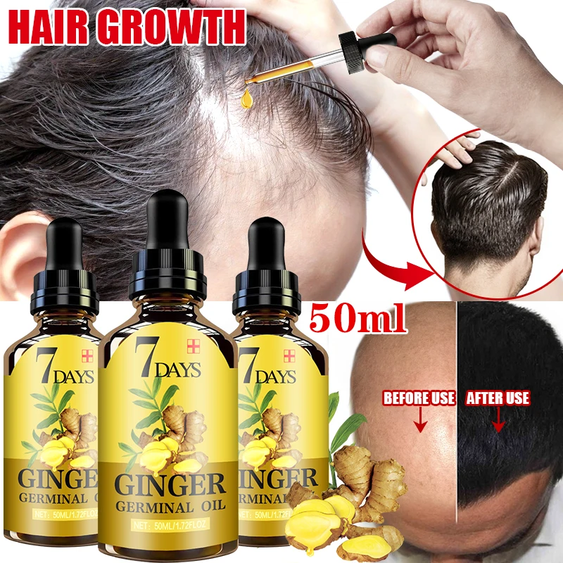 

7 day Ginger Hair Growth Nutrient Solution Hair Loss Treatment Hair Protection Essential Oil for Men Women Conditioner hair