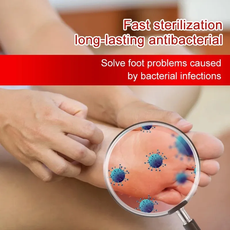 

Beriberi Removal Cream Anti Bacterial Foot Cream for Feet Rotten Peeling Itching Blisters Remove Sweat Odor Feet Ointment