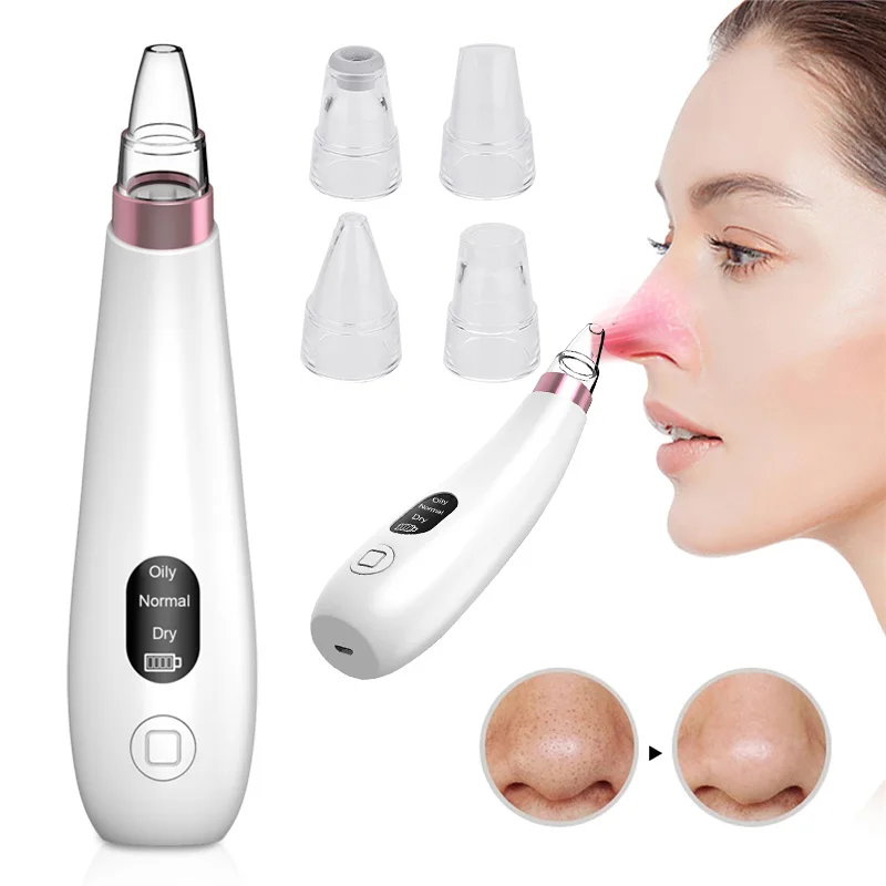 

Acne Remover Massager Dead Skin Acne Removing Apparatus Black Head Removal 4 Treatment Heads Face Cleaner Pores Cleaner Magic