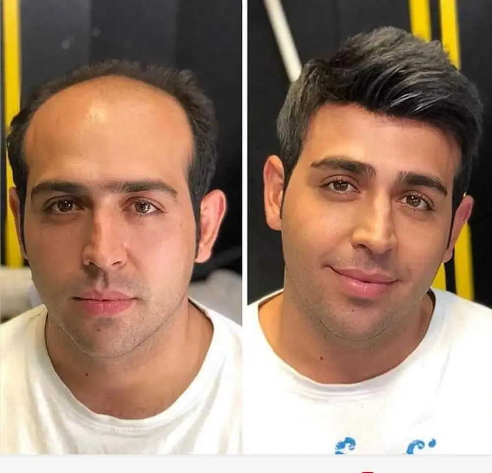 Кружевной передний парик из человеческих волос сменный Мужской моно