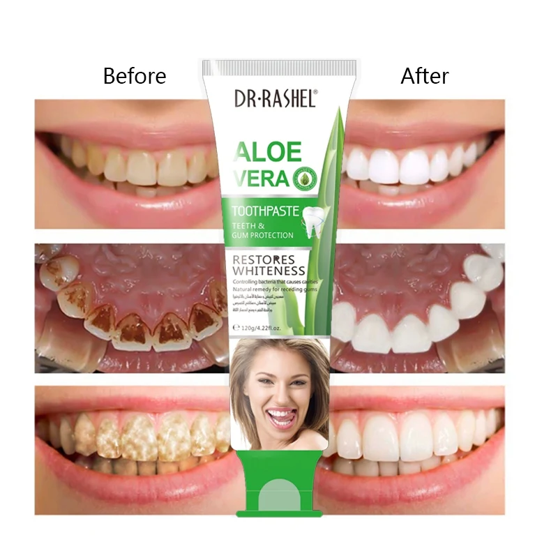 

Aloe Toothpaste Whitening Teeth Remove Oral Bacteria Dental Cream Teeth Cleansing H1