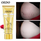 Крем Для Удаления растяжек, шрамов и растяжек для беременных, антивозрастной, против морщин, крем для тела