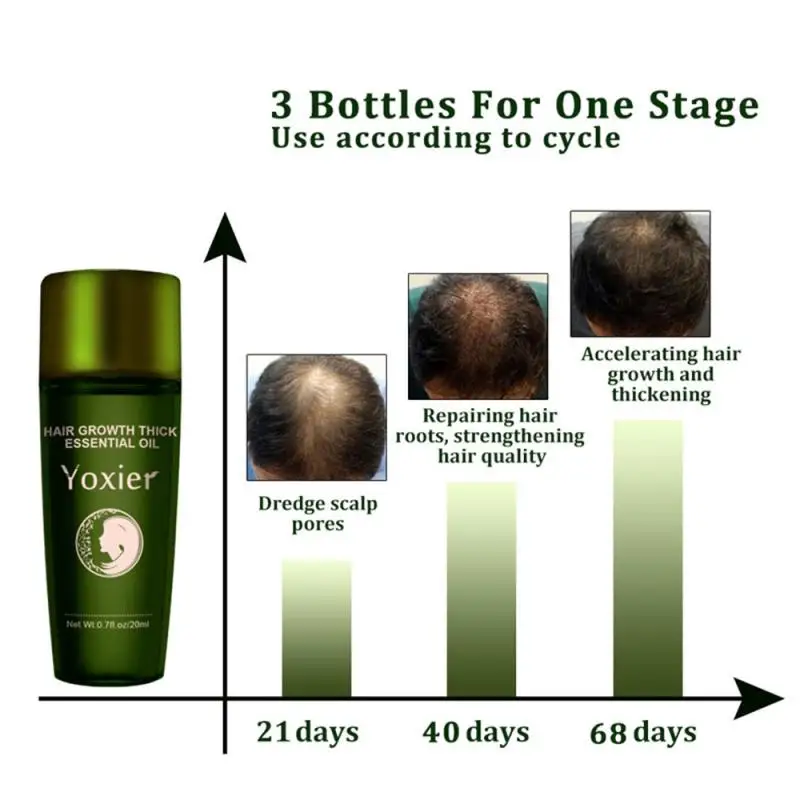 

Herbal Hair Growth Essential Oil Shampoo Hair Care Styling Hair Loss Product Thick Fast Repair Growing Treatment Liquid 20ml