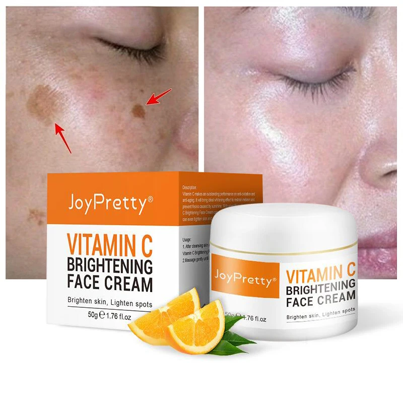 

Whitening Vitamin C Face Cream Remove Dark Spots Melanin Melasma Fade Freckle Anti-Aging Moisturizing Brighten Firming Skin Care