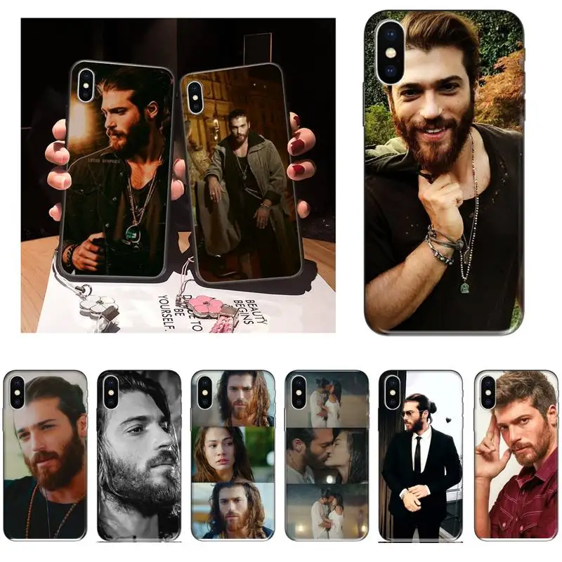 

Zororong can yaman Phone Case For iPhone 12 Mini 11 Pro XS Max X XR 7 8 Plus