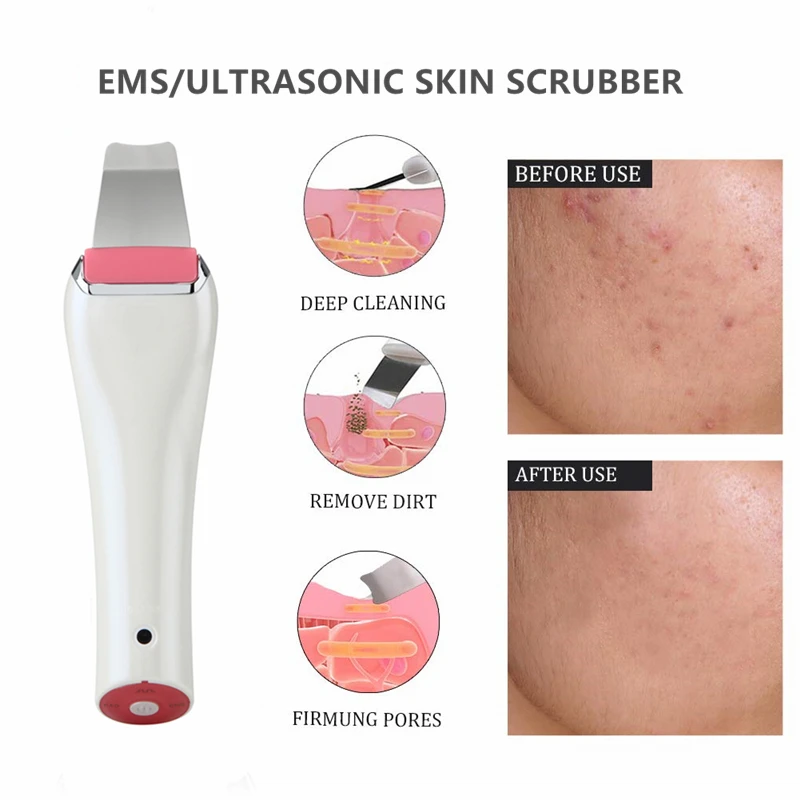 KSBELLE Высококачественная ультразвуковая машина для очистки ионов и угрей