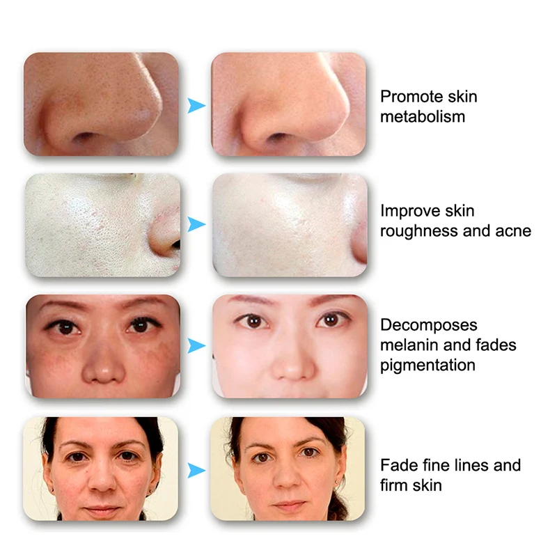 

Beauty Photon LED Facial Mask Therapy 7 Colors Light Skin Care Rejuvenation Wrinkle Acne Removal Face Beauty Spa XA75U