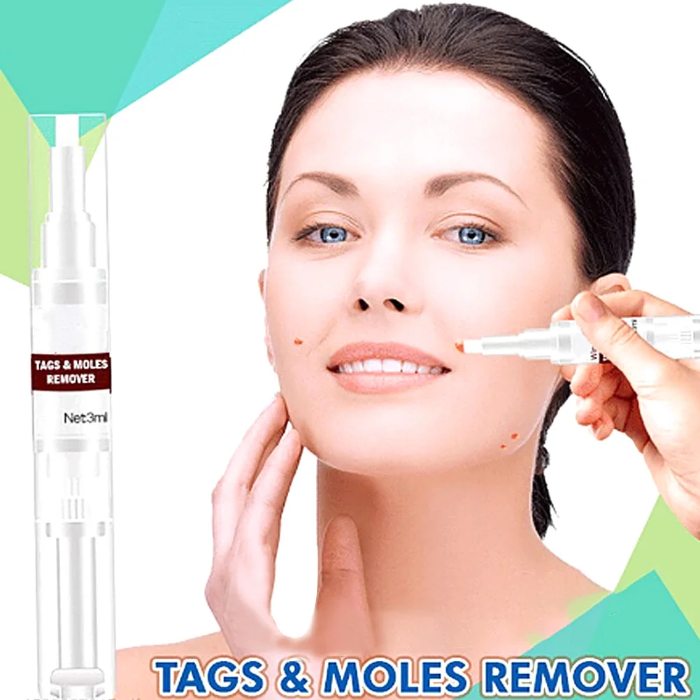 

3ml Professional Corn Mole Portable Painless Body Care Home Papillomas Treatment Moisturize Plantar Skin Tag Wart Remover Mini