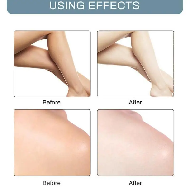 Armpit Whitening Cream Legs Knees Private Parts Formula Whitener Intimate Bleach Body for Summer | Красота и здоровье