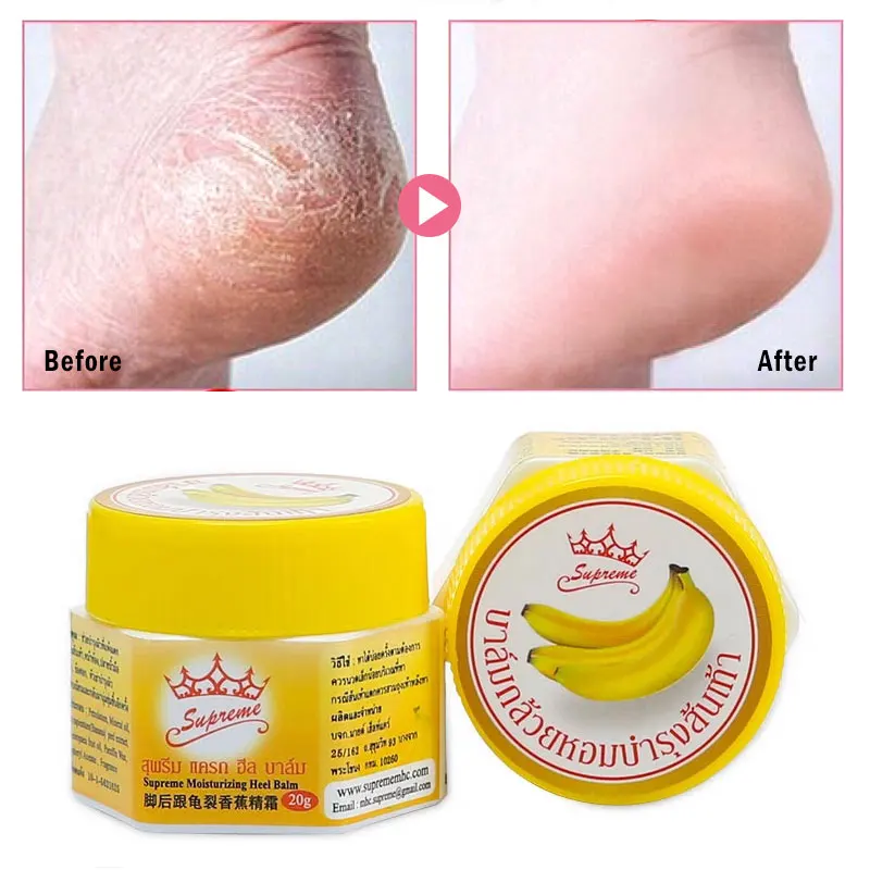 

Foot Cream Anti-cracking Moisturizing Brighten Anti-drying Anti-Aging Cracked Feet Banana Peel Extract Vitamin E Foot Care 20g