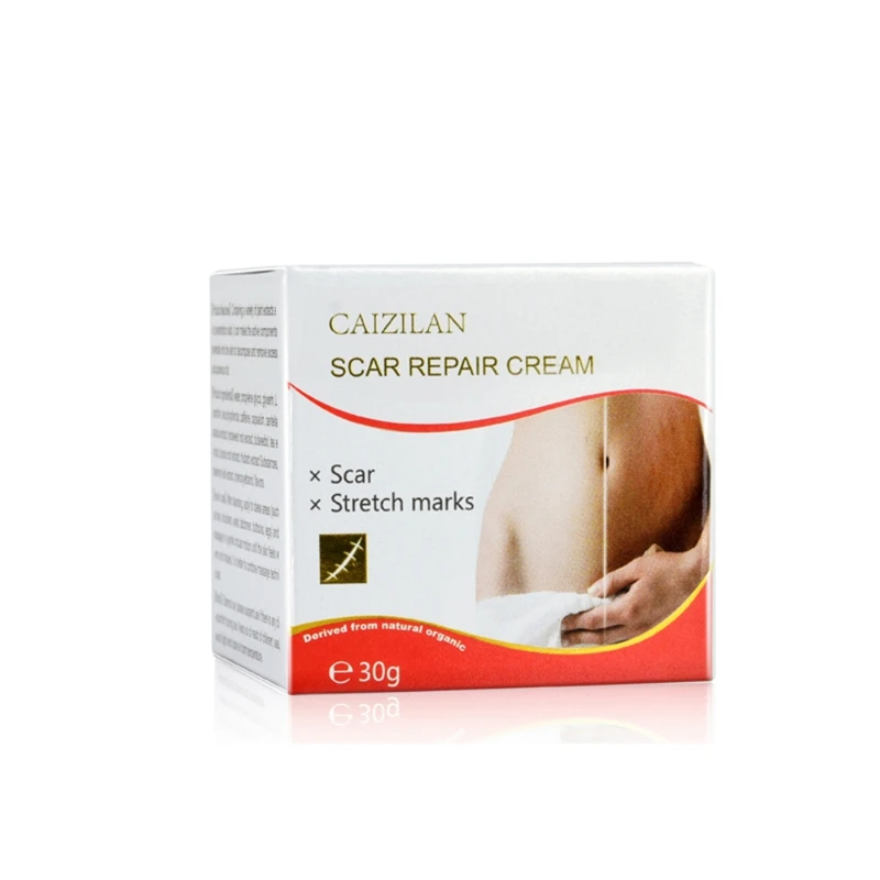 30g Acne Scar Stretch Marks Repair Cream Removal Spots Blackhead Whitening Skin For Scald Marks Skin Smoothing Scar Repair Cream