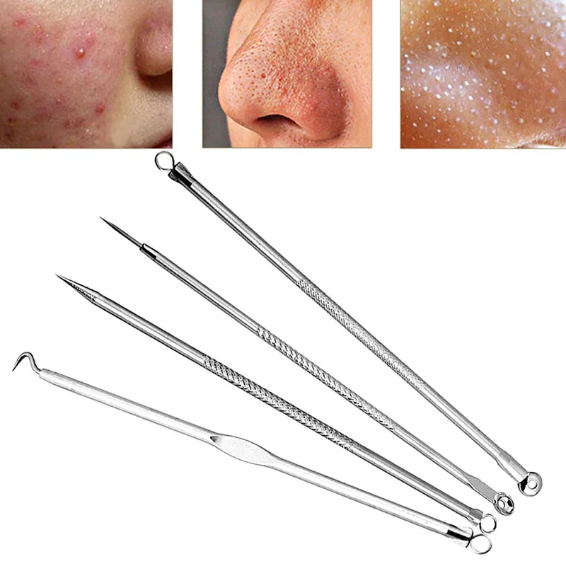 4Pcs New Nobby Pimple Acne Remover Blemish Comedone Extractor Needles Tool Set