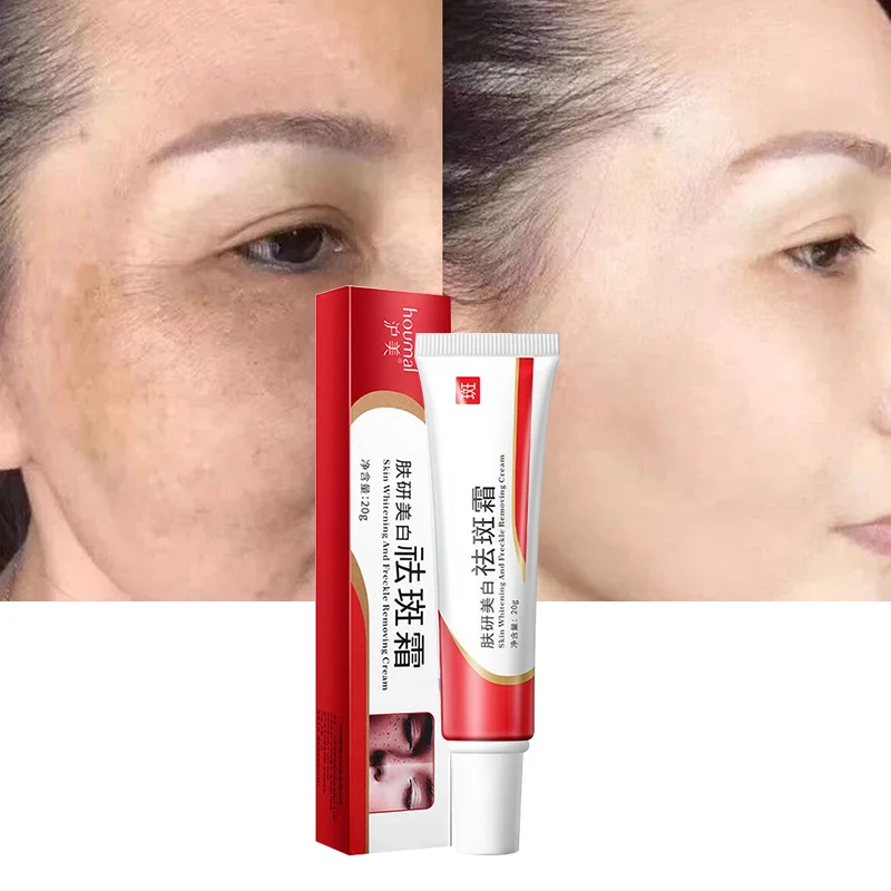

Whitening Freckle Cream Remove Melasma Cream Remove Dark Spots Melanin Melasma Remover Brighten Skin Anti-Aging Skin Lightening