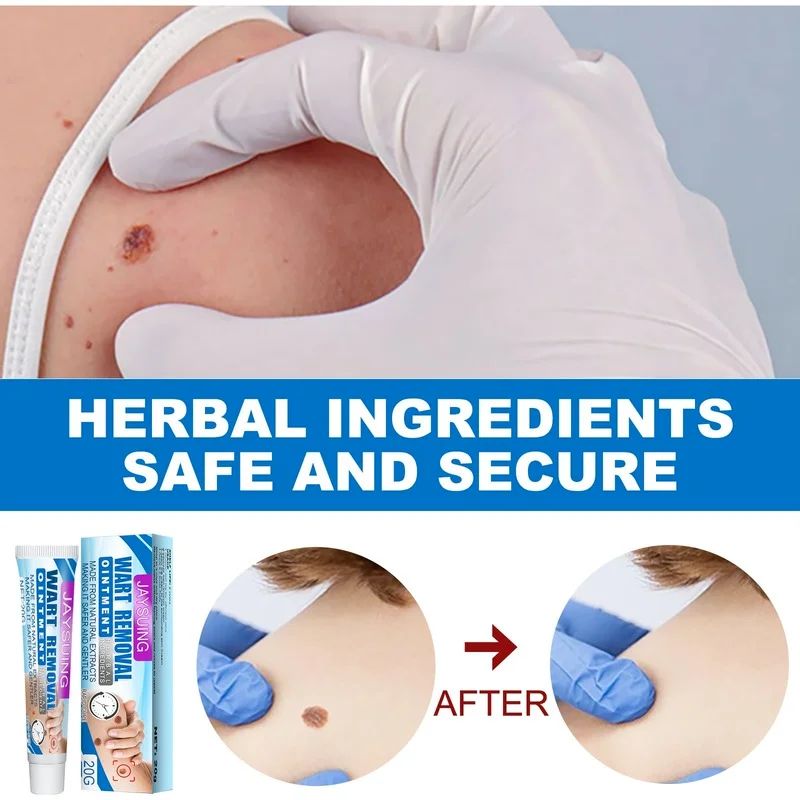 

3/1PCS Wart-removing Cream Repair Ordinary Yuke's Body, Face and Neck Skin Whitening Skin Care Products Skin Whitening Product