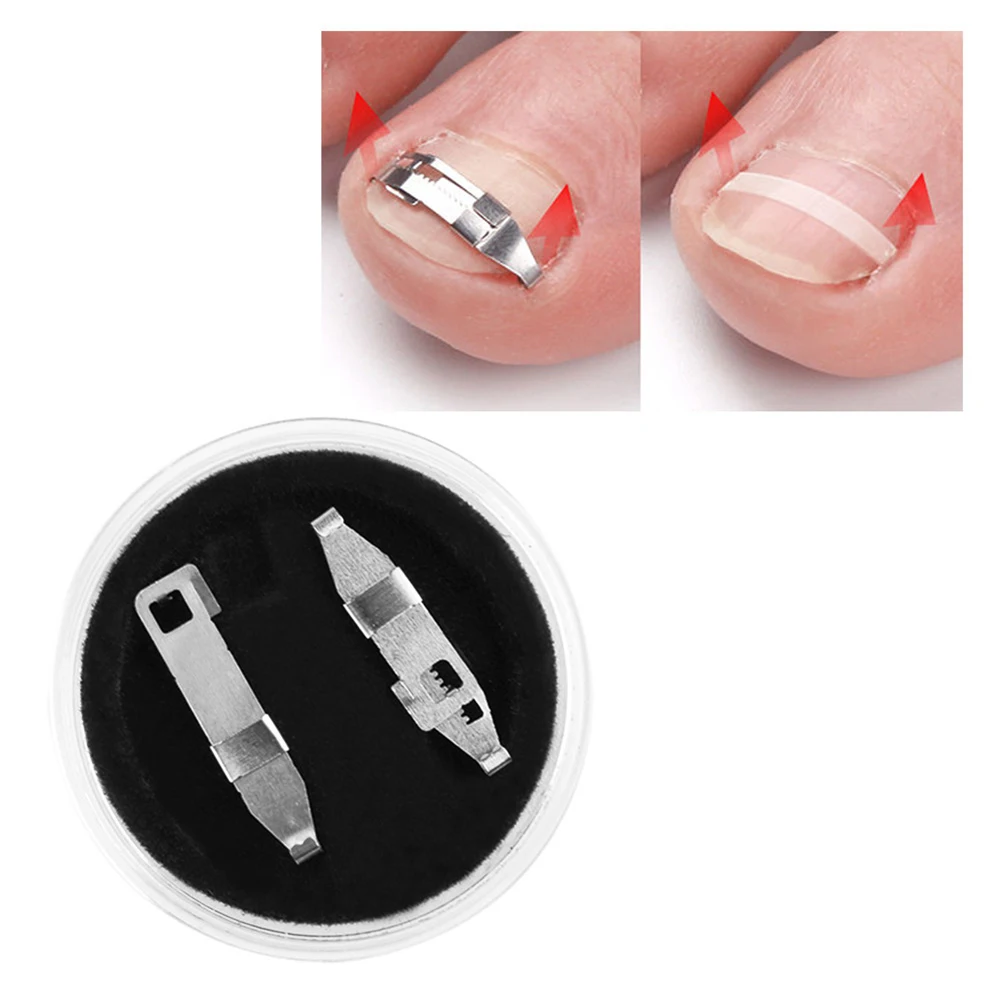 

3Pcs Ingrown Toe Nail Recover Correction Patch Pedicure Toenail Fixer Foot Care Tool Paronychia File Patch Corrector Tool
