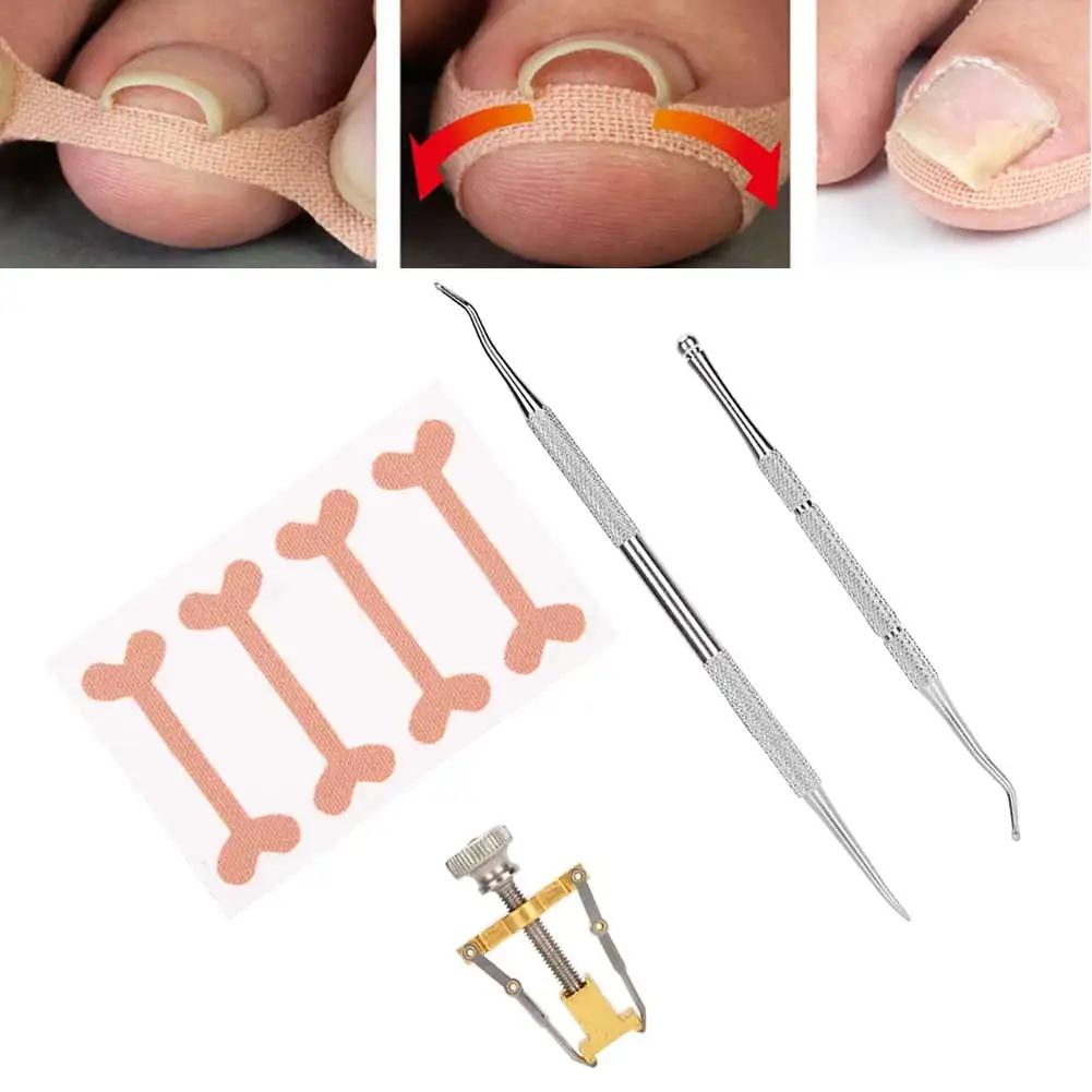 

Stainless Steel Ingrown Toenail Corrector Toenail Picker File Toe Sticker Correction Tool Set Professional Foot Nail Care Tools