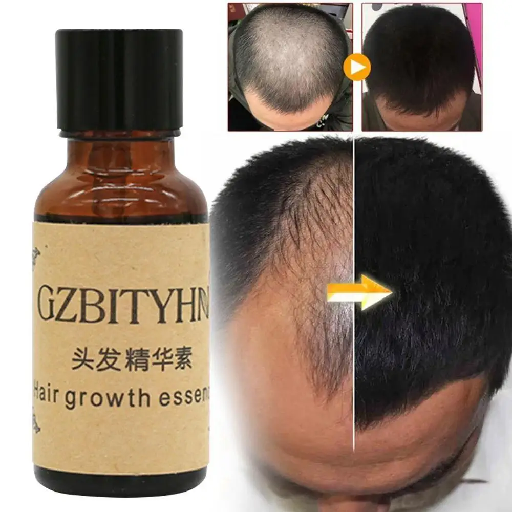 Уход за волосами жидкость для роста волос 20 мл плотное быстрое восстановление солнечных лучей пилаторское