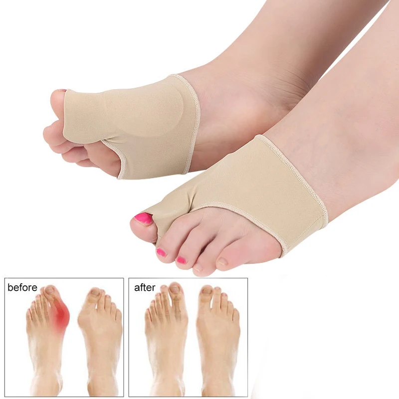 Ортопедический комплект для коррекции большого пальца стопы корректор