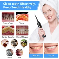 electric sonic dental whitener scaler teeth whitening kit teeth calculus tartar remover tools cleaner tooth stain oral care