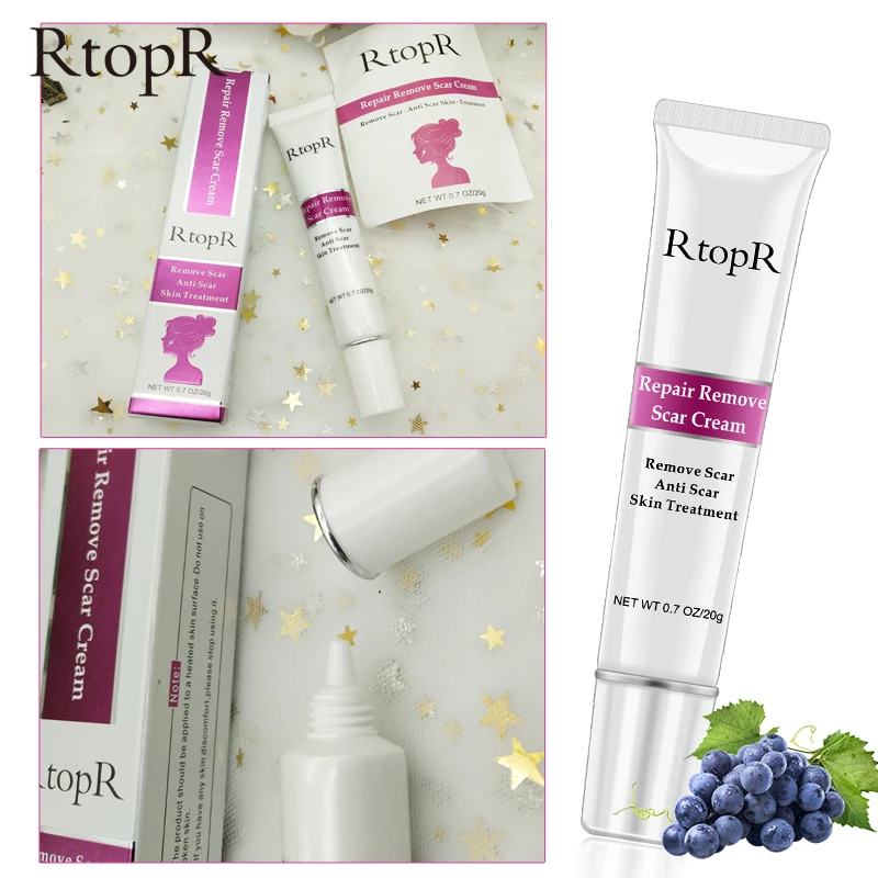 

RtopR Scar Acne Remove Cream Scars Blackhead Whitening Anti Dark Spots Repairing Body Remover Smoothing Facial Cream Skin Care