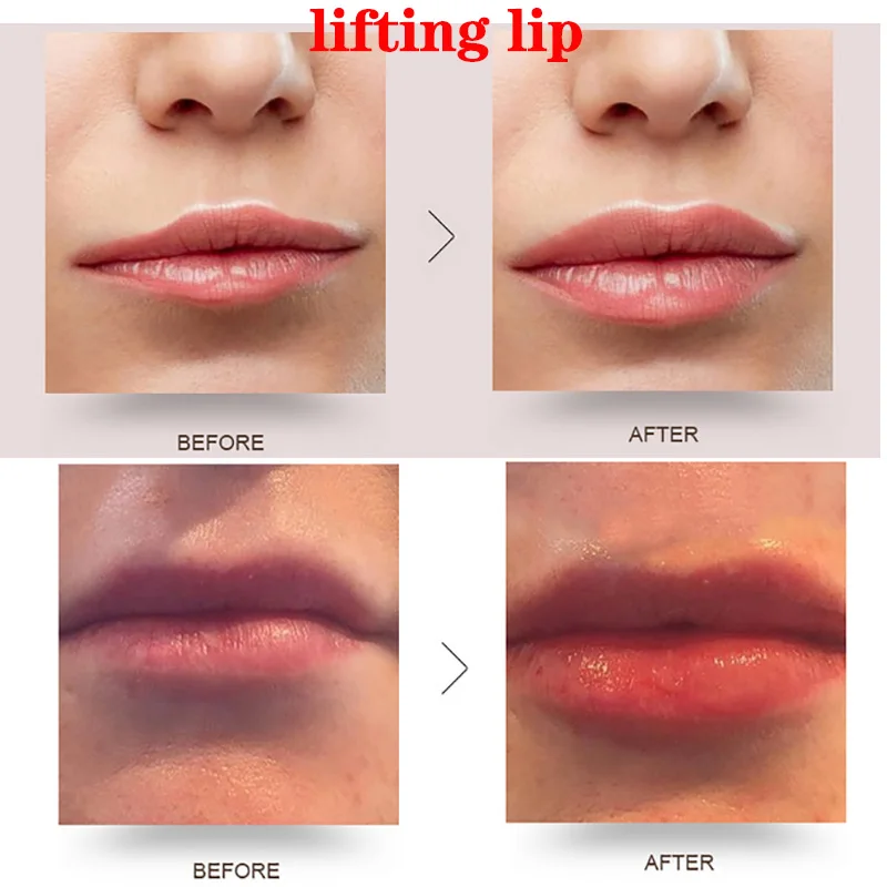 Гиалуроновая ручка с атомайзером гиалуроновой кислотой комплект для съемки