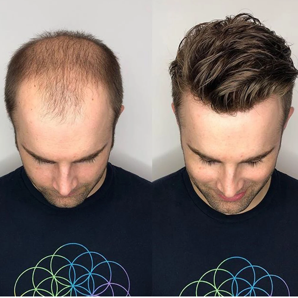 Full Poly Mens Toupee All Skin Hairpieces Blonde Thin Skin Human Hair Systems Hair Replacements All PU Wigs for Men 8x10 Inches