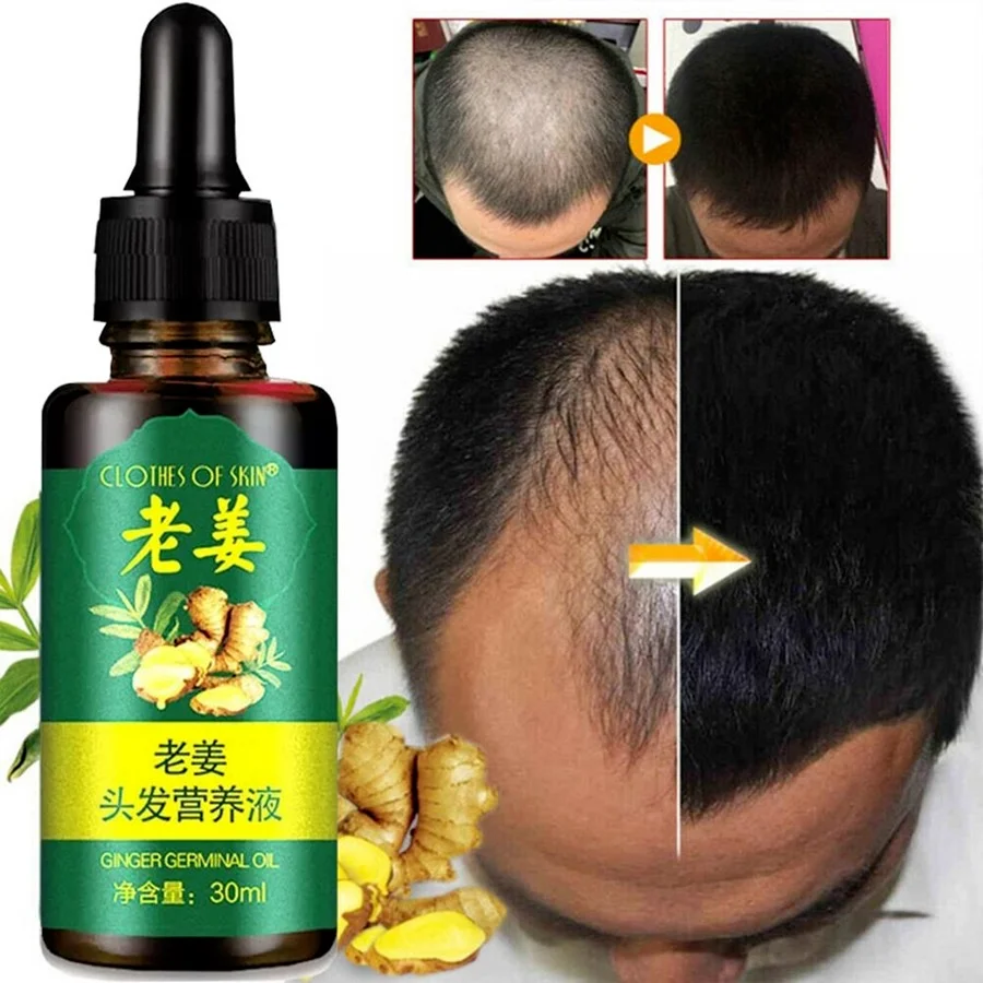 

Old Ginger Nutrient Solution Hair Care Essential Oil Ginger Hair Growth Essence Hair Growth Serum Essence Hair Loss Treatment