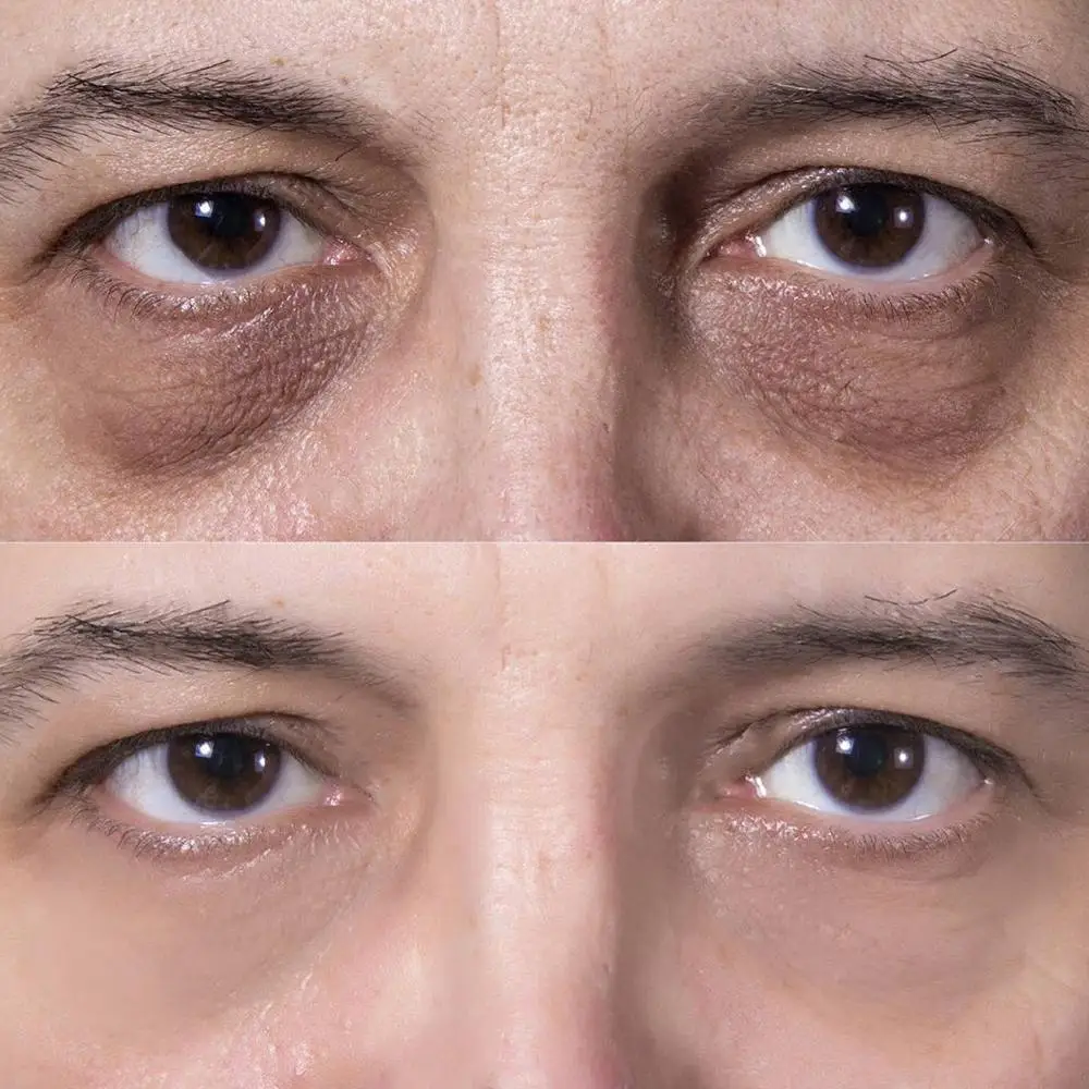 

10g, 20g, 30g Day And Night Men's Eye Cream Dark Circles Eye The Remover Bags Cream Of Skin Eyes Tight Men Aging Care Under S8Z8