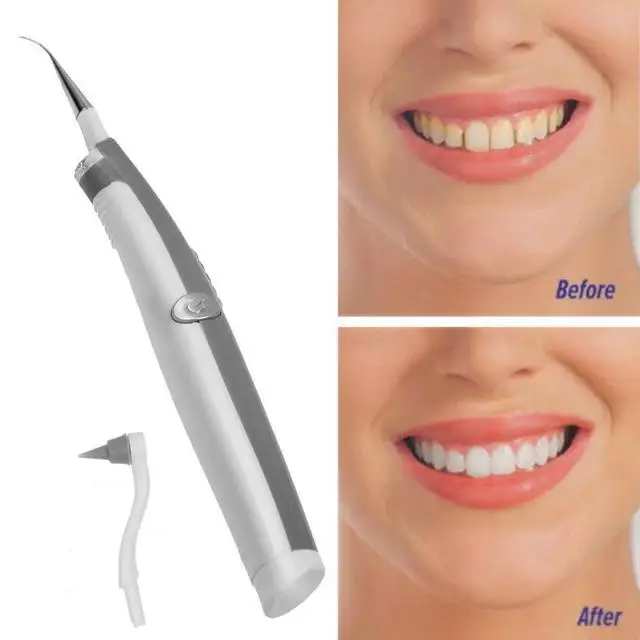 

Electric Ultrasonic Sonic Tooth Oral Stain Eraser Plaque Remover Dental Tool Teeth Whitening Cleansing Scaler Vibrating Gum Care