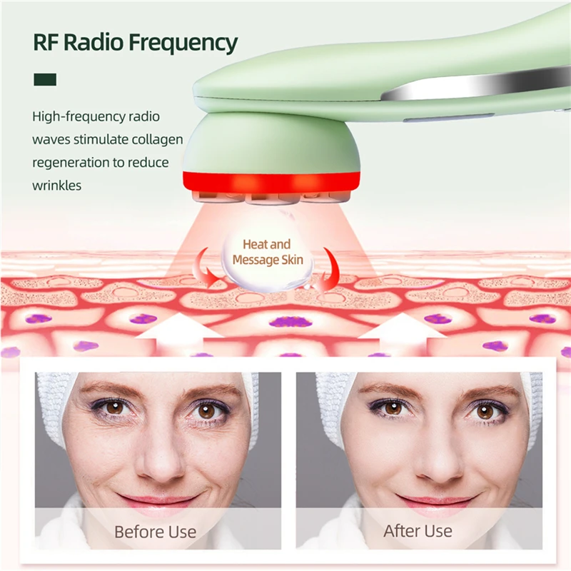 Goedkoop Ckeyin Ems Microstroom Rf Radio Frequentie Facial Lifting Schoonheid Apparaat Ultrasone Infrarood Lichaam Vermagering Huid Draai Massager