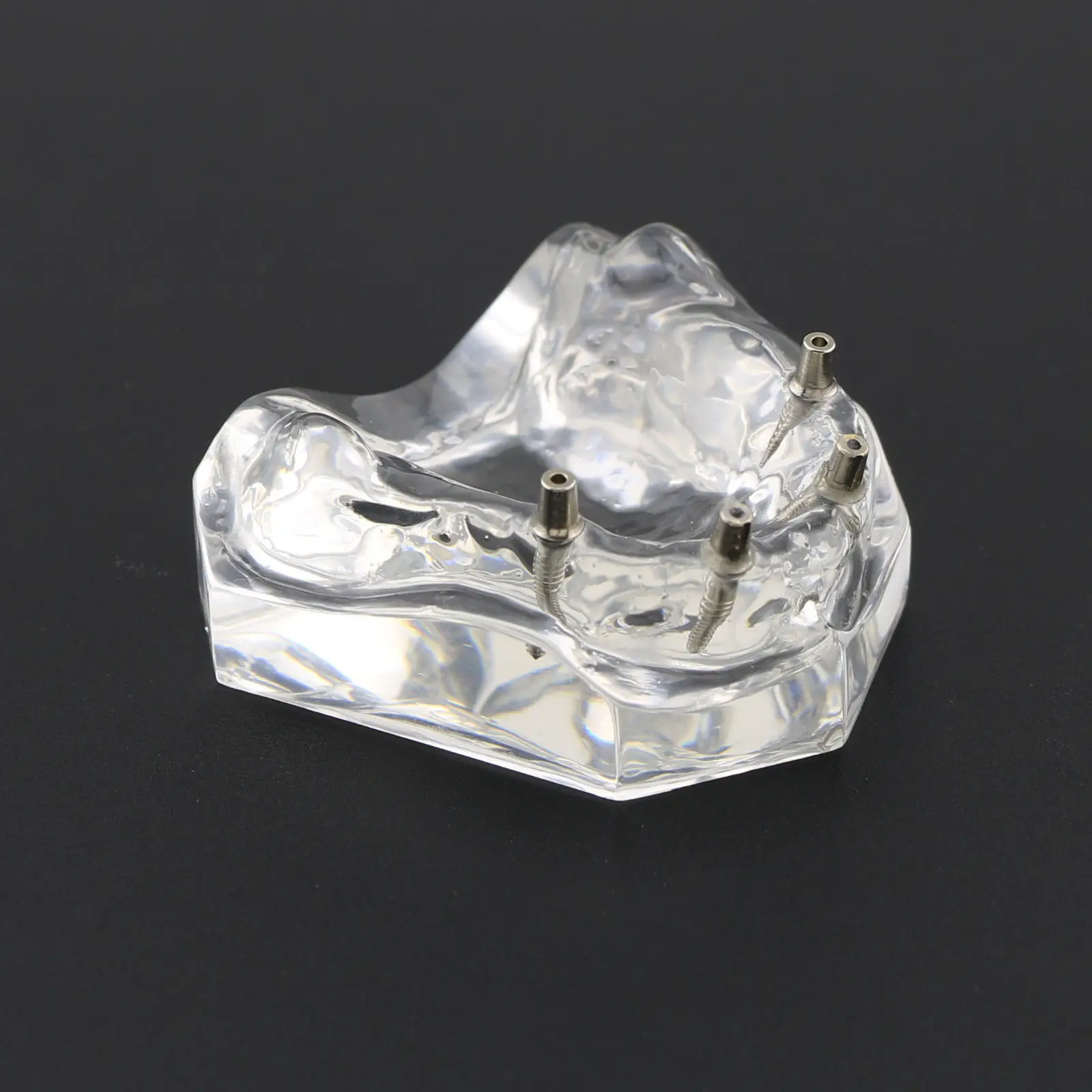 1 шт./упак. Dental Upper Overdenture Superior 4 имплантаты демо модель 6001 02