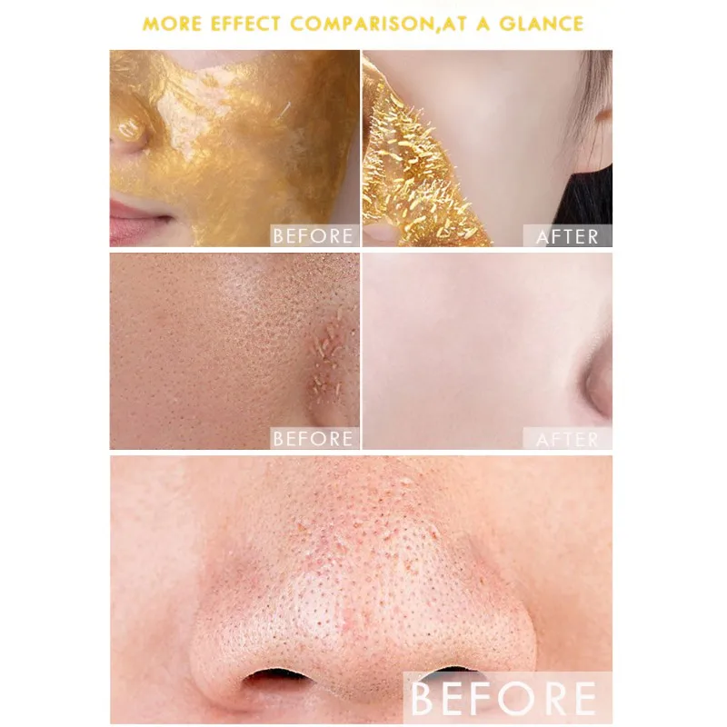 Поп 40g золото коллаген для лица отшелушивающая маска blackhead стартовый комплект evod