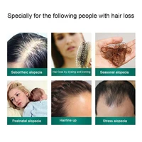 1pc 30ml hair growth essence spray anti hair loss germinal growth carry nourish to serum hair men care roots women hair eas r2g1