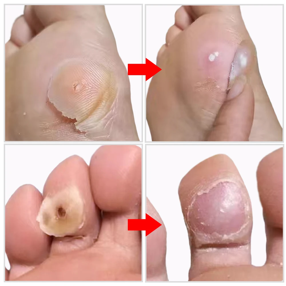 Отшелушивающая Маска-пилинг для ног мозоли ороговелости удаления омертвевшей