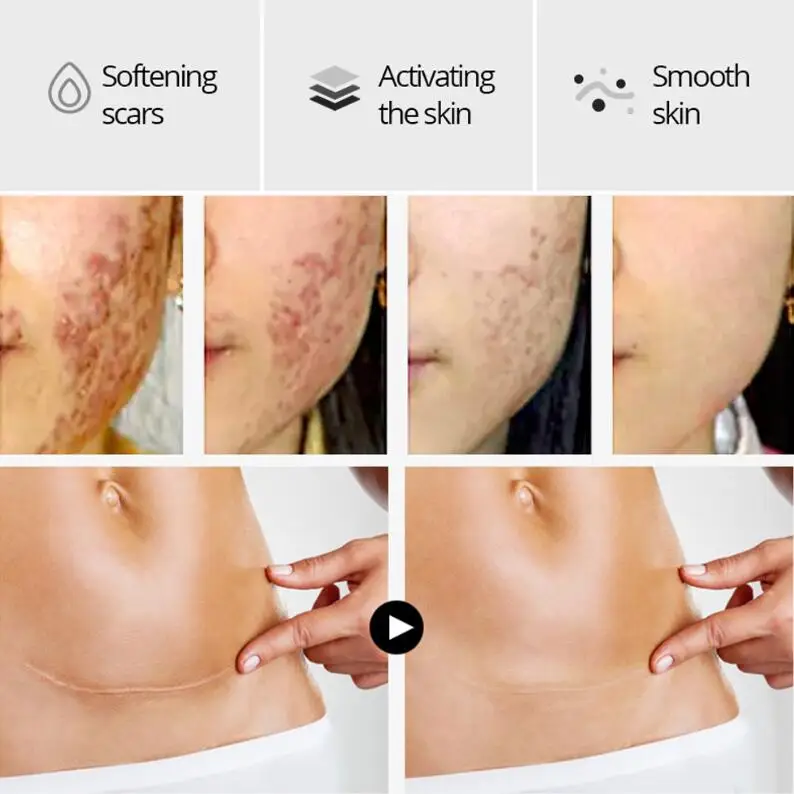 Эссенция для замены кожи крокодила | Красота и здоровье