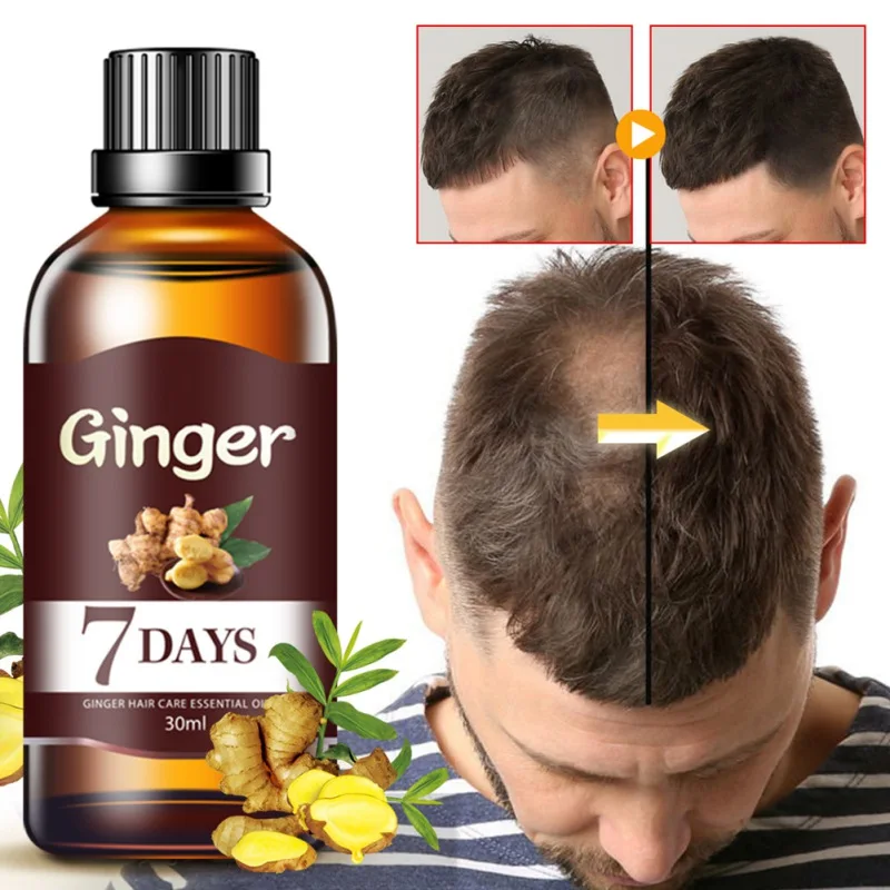 

30ML 7 Days Fast Hair Growth Essence Oil Ginger Hair Growth Serum Nourishing Soften Treatment Hair Loss Repair Damaged Hair